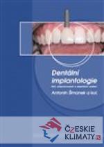 Dentální implantologie - książka