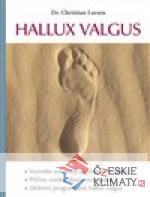 Hallux valgus - książka