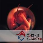 Až přiletí tučňák - audiobook