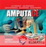 Amputace