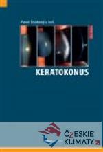 Keratokonus