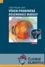 Věkem podmíněná degenerace makuly