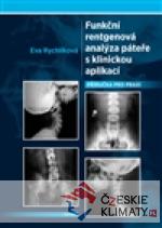 Funkční rentgenová analýza páteře s klin...