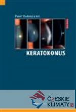 Keratokonus - książka