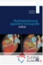 Multidetektorová výpočetní tomografie srdce - książka