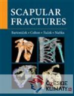 Scapular fractures - książka